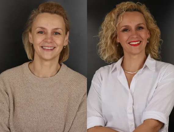 Aponia patient before and after Hollywood Smile